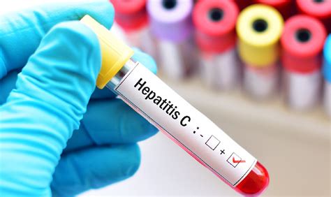 Hepatitis Qué Tipos Hay Y Cómo Prevenirla Radio Eme