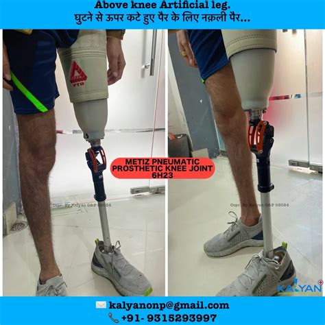 Above Knee Artificial Leg Light Weight At Rs Piece Artificial