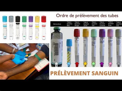 Dans quel ordre doit on utiliser les tubes de prélèvement Tout savoir