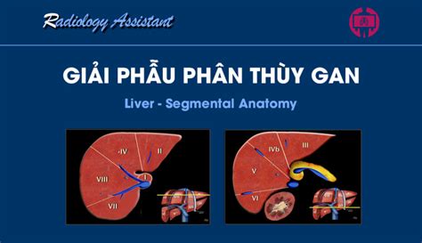 Gi I Ph U Ph N Th Y Gan Liver Segmental Anatomy H Nh Nh Y Khoa