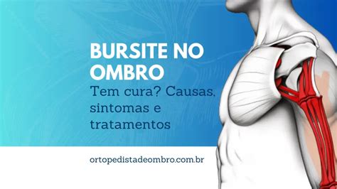 Bursite no ombro tem cura Conheça as causas sintomas e tratamentos