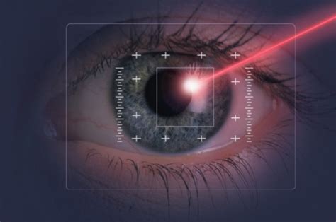 Laser Eye Surgery Risks and Side Effects