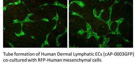 GFP Expressing Human Dermal Lymphatic Microvascular Endothelial Cells