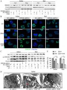 Hmgb1 Translocation Is Involved In The Transformation Of Autophagy