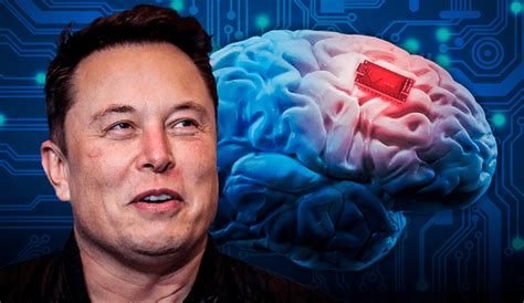 Elon Musk Neuralink Obtiene Permiso Para Implantar Chips En Cerebros