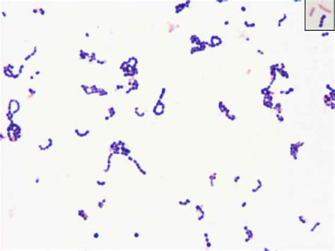 Peptostreptococcus Gram Stain