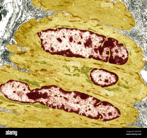 Intestinal Smooth Muscle Cells Coloured Transmission Electron