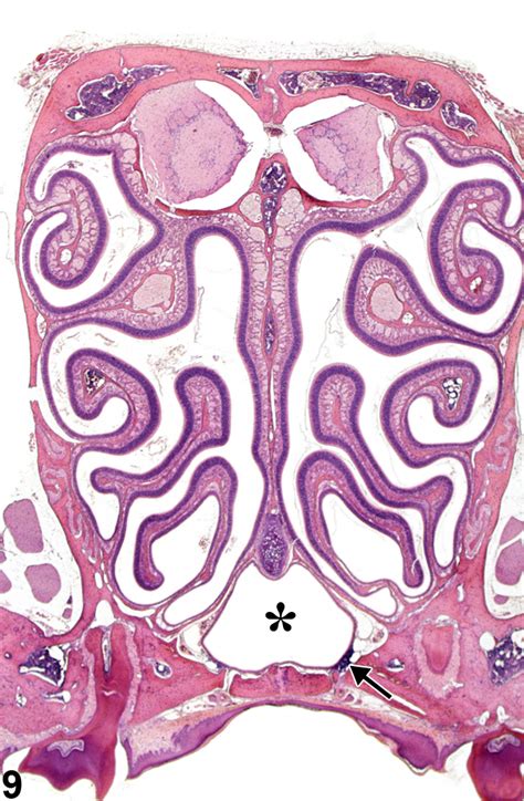 Nose Nonneoplastic Lesion Atlas