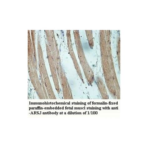 ARSJ Antibody Supplier CAS AOBIOUS