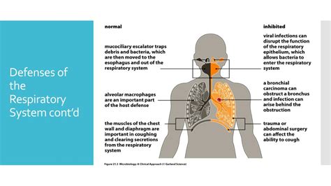 PPT Infections Of The Respiratory System PowerPoint Presentation