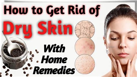 How To Treat Dry Skin Simple Home Remedies For Dry Skin How To Get