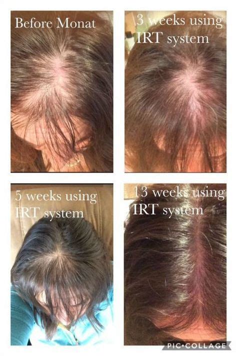 Biotin Hair Growth Before And After Pictures Male Cool Part Diary Stills Gallery