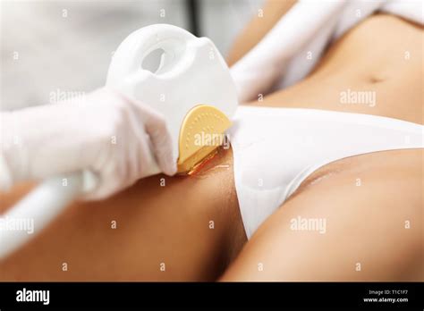 Picture Of Beautician Giving Epilation Laser Treatment To Woman On Bikini Stock Photo Alamy