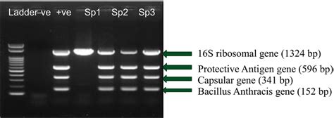 A Greyish White Non Haemolytic Colonies Of Bacillus Anthracis On