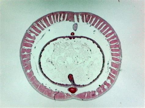 Earthworm Posterior Cross Section Prepared Microscope Slide