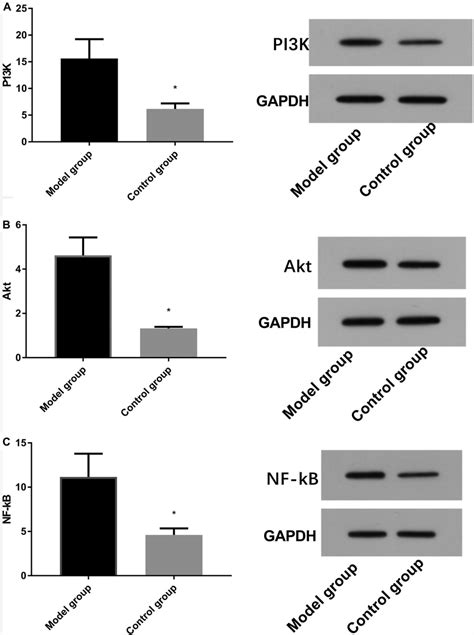 Comparison of protein expression between model and control groups by ...