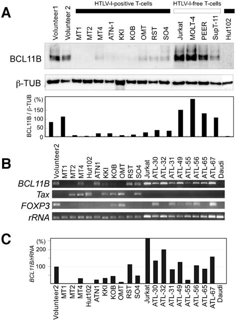 Reduced Level Of The Bcl11b Protein Is Associated With Adult T Cell