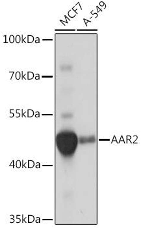 Anti Aar2 抗体 Cab18443 Assay Genie