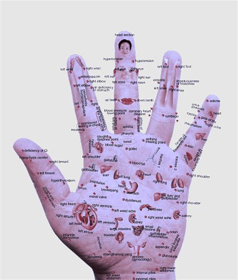 Hand Acupuncture Stomach Ache Pressure Point Akupunktiopiste Tui Na