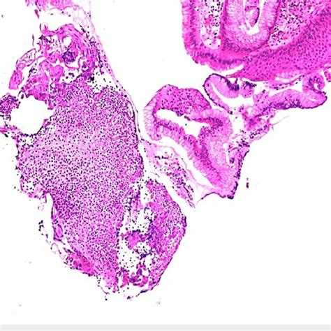 Microphotograph Hematoxylin And Eosin Stain X100 Showing