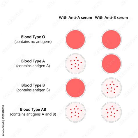 Blood typing of ABO blood types. Stock Vector | Adobe Stock