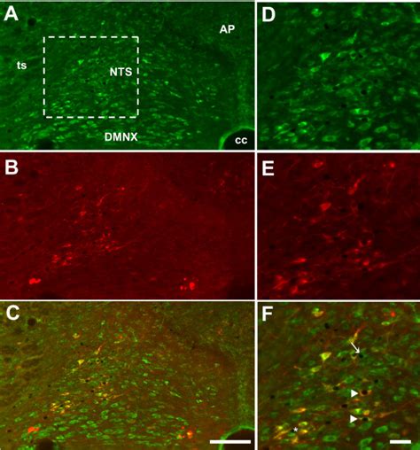 Representative Photomicrographs Of C Fos DAB Precipitate Nesfatin 1