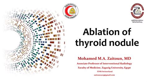 Thyroid Ablationpptx