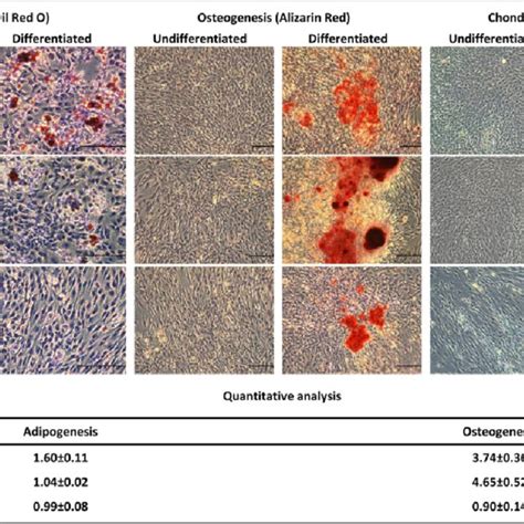 Morphology Of Adipose Derived Mesenchymal Stromal Stem Cells During A