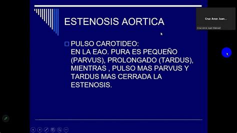 Estenosis Aortica Youtube