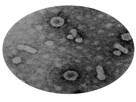 HBV – The Hepadnaviridae family prototype | Download Scientific Diagram