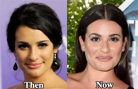 Lea Michele Nose Job Plastic Surgery Before and After Photos - Latest Plastic Surgery Gossip And ...