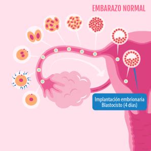 Implantaci N Fase Clave Del Embarazo Espont Neo Y Por Fiv Natalben