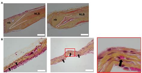 Frontiers D Bioprinting Of Vascularized Tissues For In Vitro And In