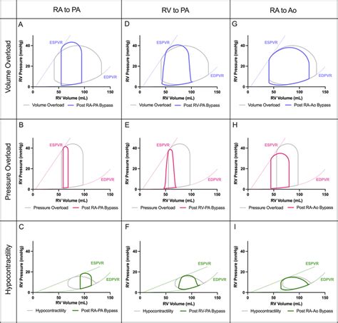 Pressure Volume Loops Reflecting The Hemodynamic Impact Of Various