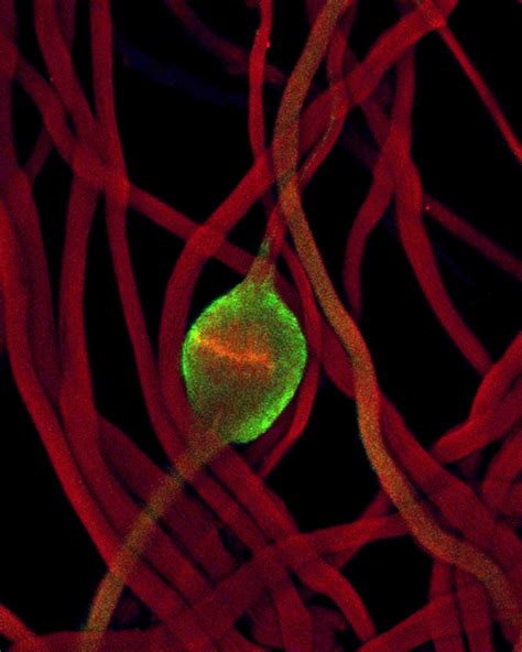 Drosophila Melanogaster Cytoplasm Cil Doccheck