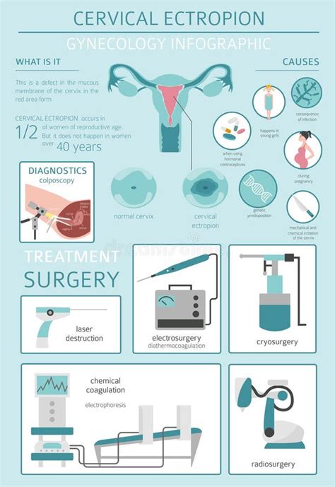 Cervical Ectropion Cervix