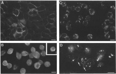 Localization Of Vlp N Caveolin In Okadaic Acid Treated A Cells