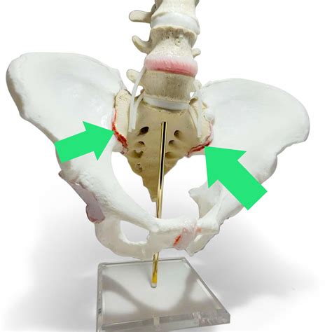 Sacroiliac Joint Dysfunction: Understanding Chondrocyte Clustering and ...