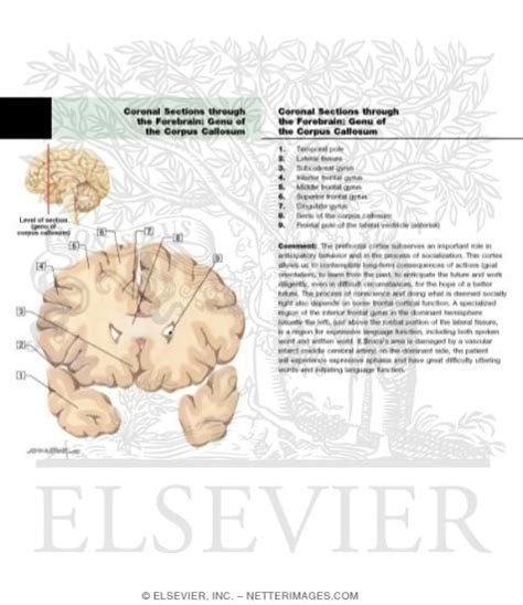 Coronal Sections Through The Forebrain Genu Of Corpus Callosum