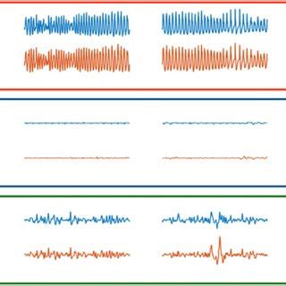 Induced seizure (upper panel) and immediate postictal state (middle... | Download Scientific Diagram