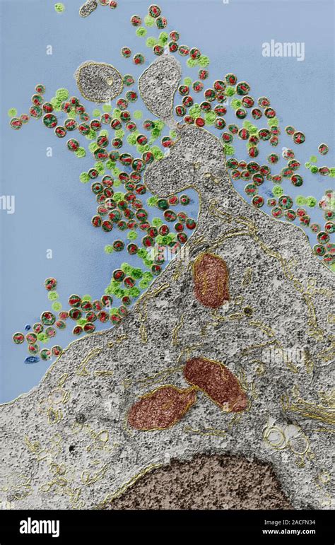 Budding Hiv Particles Coloured Transmission Electron Micrograph Tem