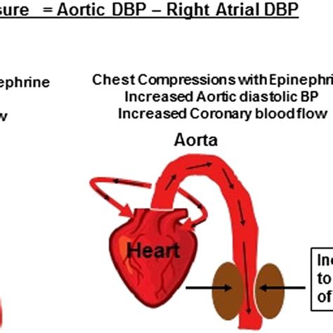 Pdf Epinephrine Use During Newborn Resuscitation