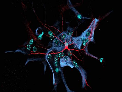 A nerve cell serves as a "single" for studies