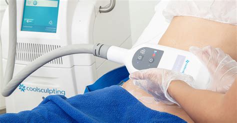 Coolsculpting Em Florian Polis A Solu O Para Se Livrar Da Gordurinha