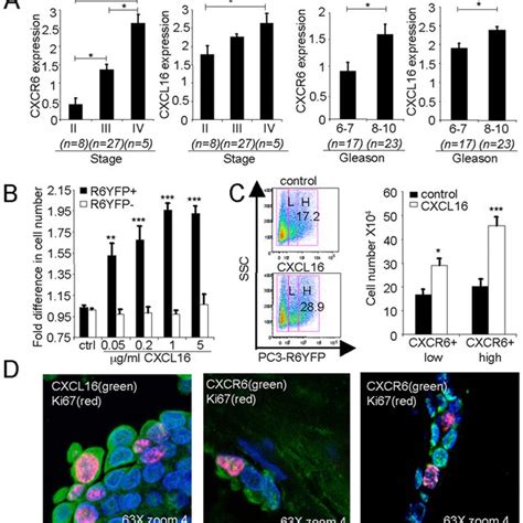 Roles For Cxcl And Cxcr In Prostate Cancer Stage Grade And Cell