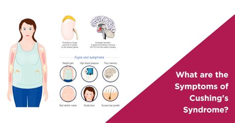 Understanding Cushings Syndrome Symptoms Nova Ivf Fertility