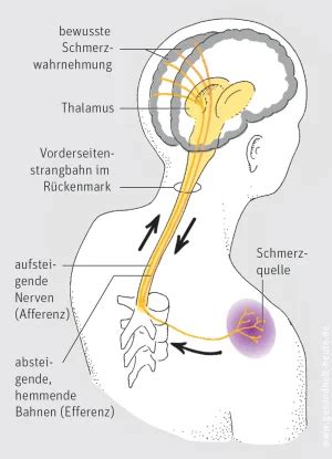 Wie Schmerzen Entstehen