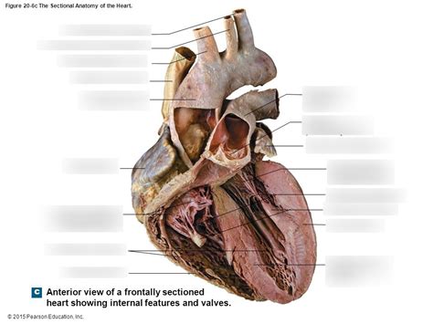 Anterior Section Of Heart Diagram Quizlet