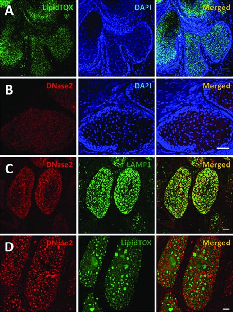 Cellular Location Of DNase2 In The Human Meibomian Gland MG To