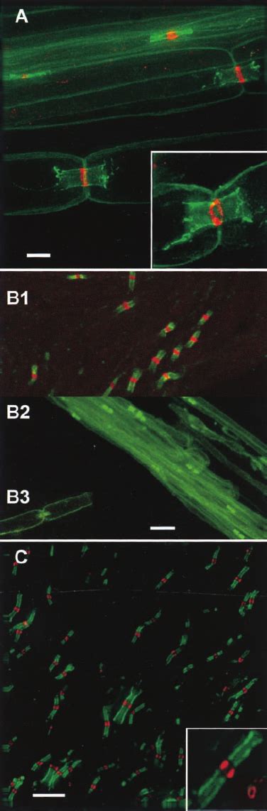 Node Of Ranvier Labeling In The PNS Rat And Mouse Sciatic And CNS